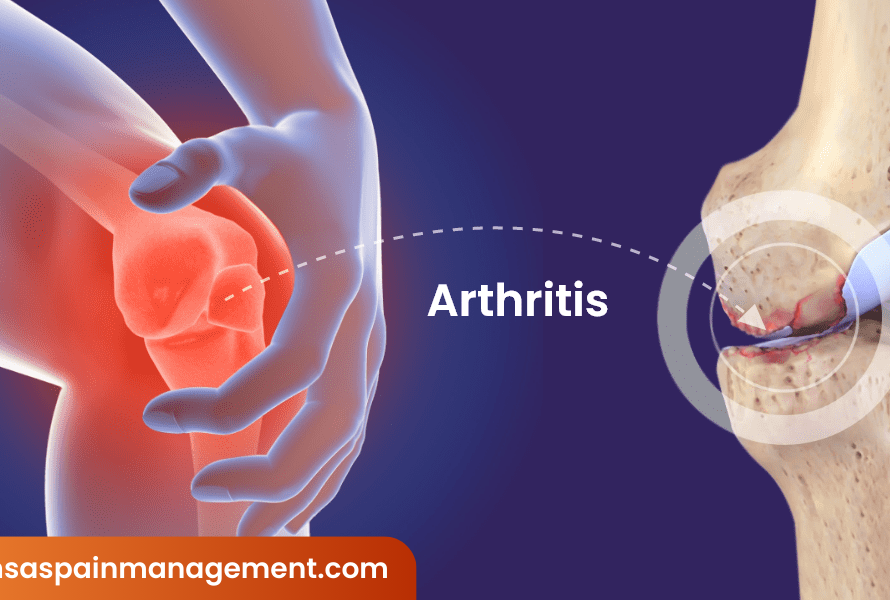Arthritis-img